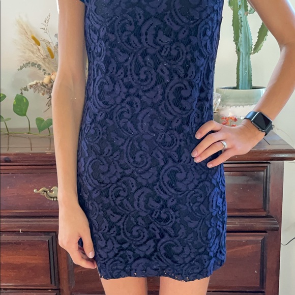 Club Monaco lace mini dress - Picture 2 of 2